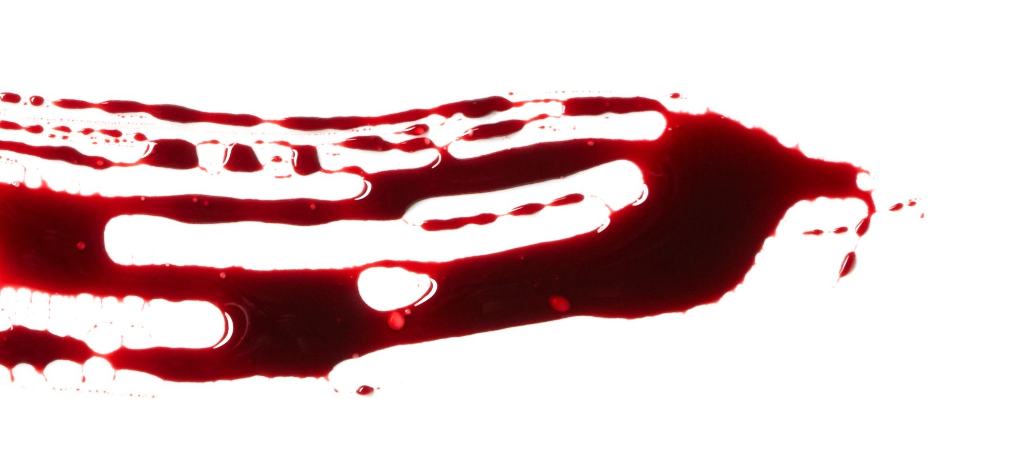 blood stains